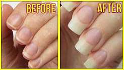 5 Ways to Grow Your Nails FAST! 